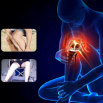 ماساژور هوشمند زانو Knee Massager - Image 7